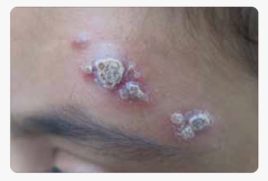 EHabibullaah's tweet photo. @IhabFathiSulima Diagnosis? https://t.co/3xs6Q6xk5f