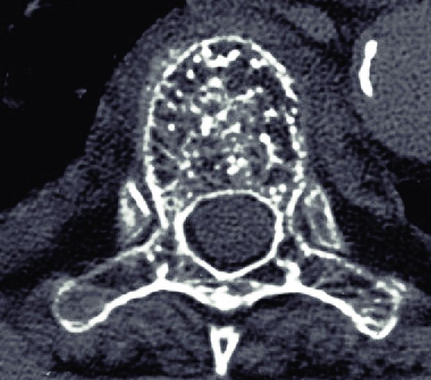 IhabFathiSulima's tweet photo. What is the radiological description?
What is the diagnosis? https://t.co/1wSQk39veG