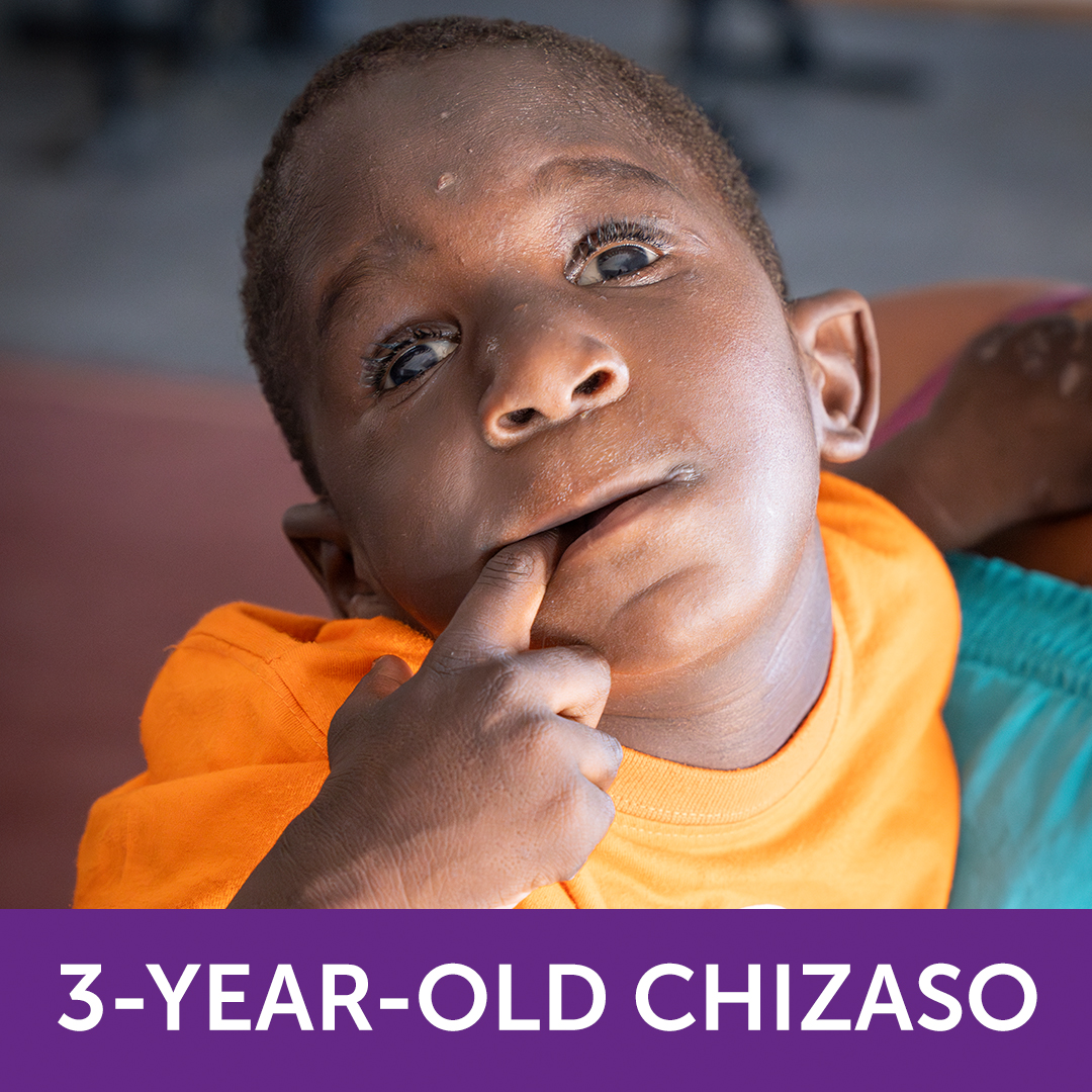 HopeHealingIntl's tweet photo. #HopeIs physiotherapy for 3-year-old Chizaso.
We got to watch him practice his walking – using life-changing devices that friends like you shipped and the strength he gained during his physiotherapy that you made possible. Thank you for helping this little boy! https://t.co/VK0IQfM2Iy