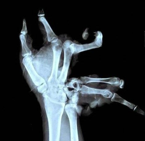 That's how my hands feel after a very sweaty singularity game 

#DeadbyDaylight