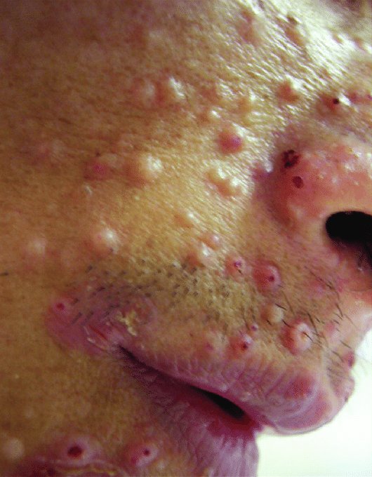 Dr Ihab Suliman tweet media