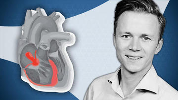 New from #PCRtricuspid ! An educational series on HF/RV function & Tricuspid Regurgitation. In episode 1⃣ @kp_rommel shares insights relevant to the hemodynamic diagnosis of TR-related right #heartfailure. Learn how to 🔵recognize the intricate relationship between symptoms…