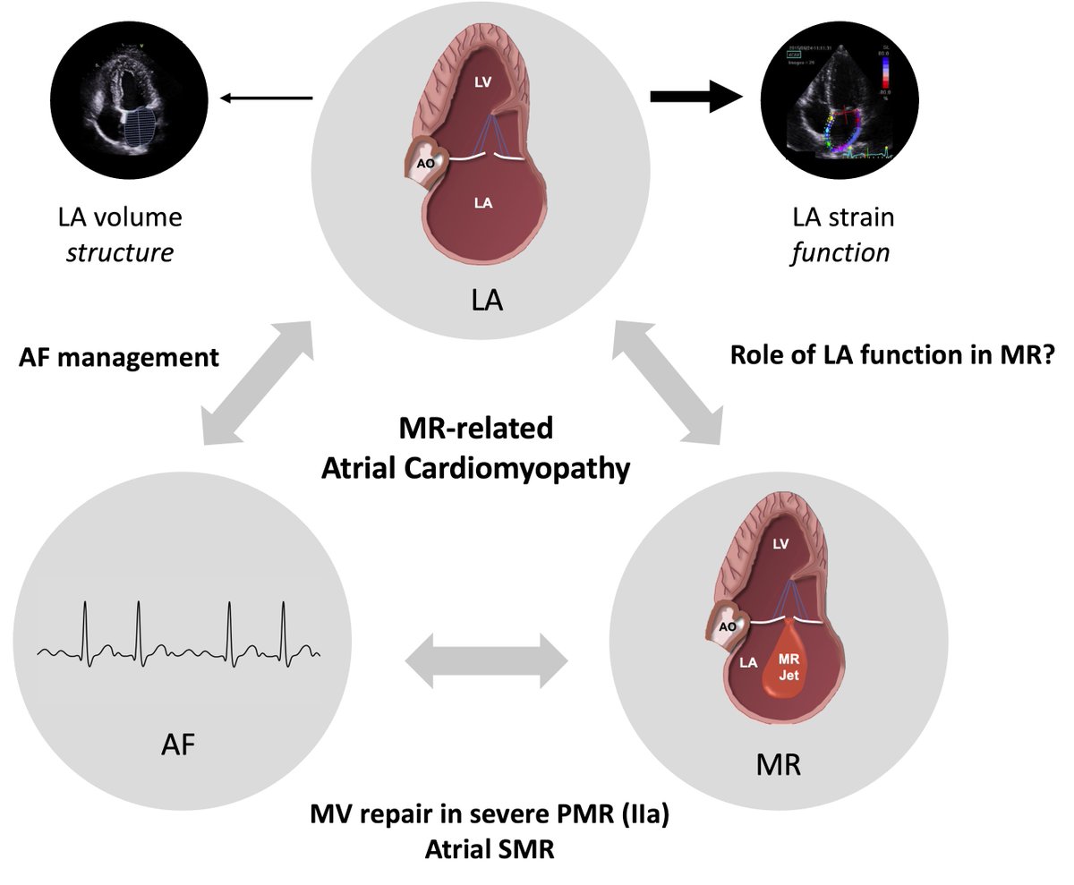 🔎 Mitral Regurgitation, The Left Atrium and Atrial Fibrillation: Unlikely Bedfellows or Natural Kindreds? 🎯 Happy to share the editorial performed with my friends @ManiVannanheart & @PatrizioLancel2 regarding the study from Yafasov et al. 🌐 academic.oup.com/ehjcimaging/ar…