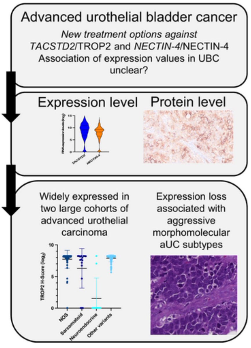 andrepcdc's tweet image. As ADCs come into play and precision medicine evolves, it becomes more important to improve patient selection for therapies in aUC. Great study on the expression of TROP2 and NECTIN-4, by @Markuseckstein3 and colleagues. Maybe ADCs are not for everyone.

onlinelibrary.wiley.com/doi/10.1111/hi…
