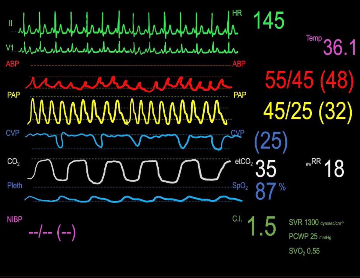 Saikat Mitra tweet media