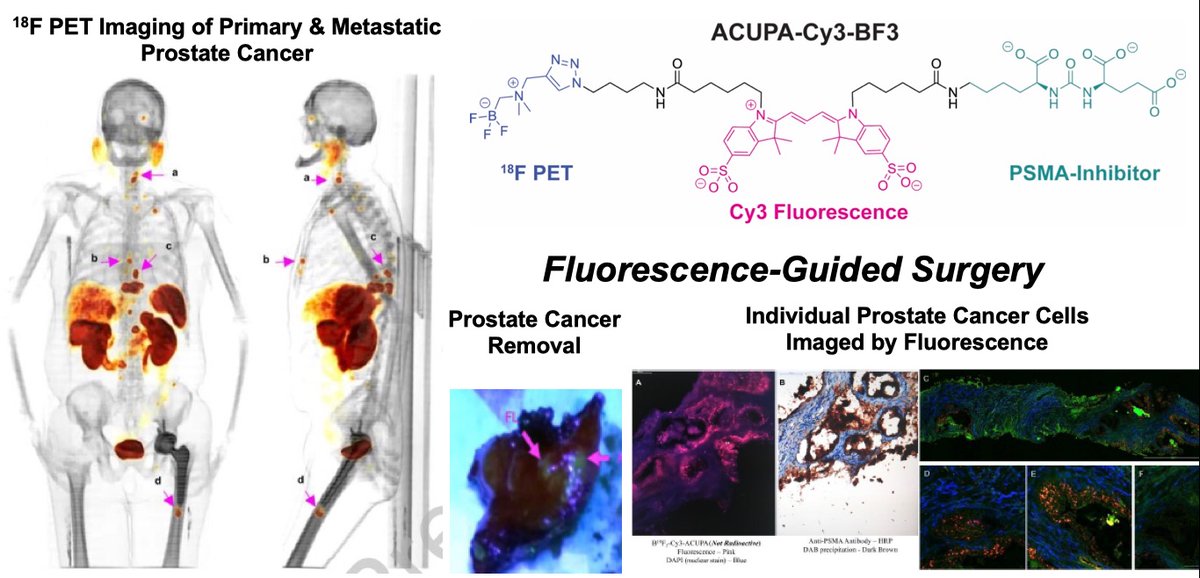 🆘World Cancer Day!🆘 Our work uses PET & fluorescence to locate & remove primary & metastatic cancer. We started two companies to get the molecules into the clinic!❤️‍🩹 #WorldCancerDay doi.org/10.1021/acsche… doi.org/10.1021/acs.bi… doi.org/10.1177/027167… doi.org/10.1016/j.clgc…