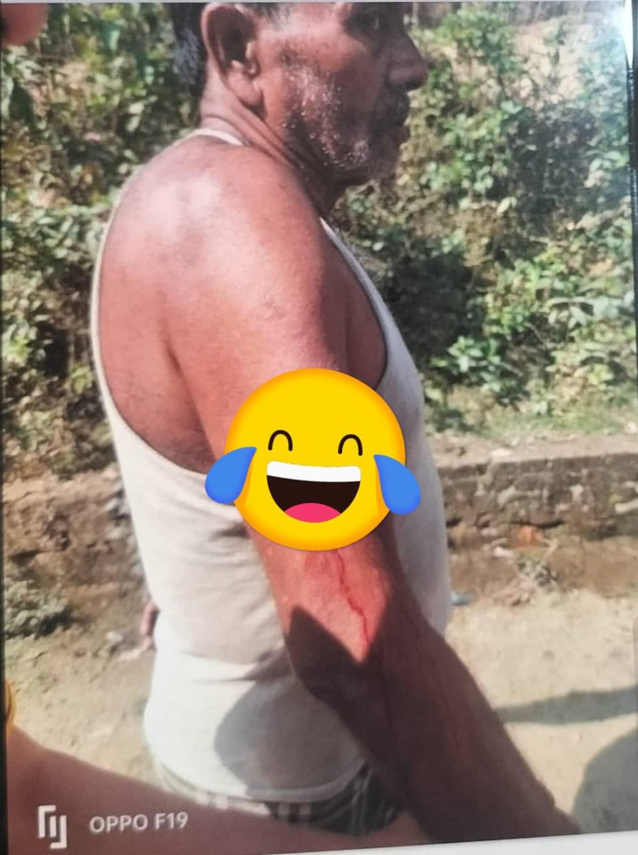 YasinAr85036736's tweet image. A local Bangladeshi man was wounded by bullet during heavily gunfire at the Border guard between Myanmar and Bangladesh. 

This incident should be fortified and the people of Bangladesh should have a safe life who live beside Border. 

#Savethem
#Helpthem