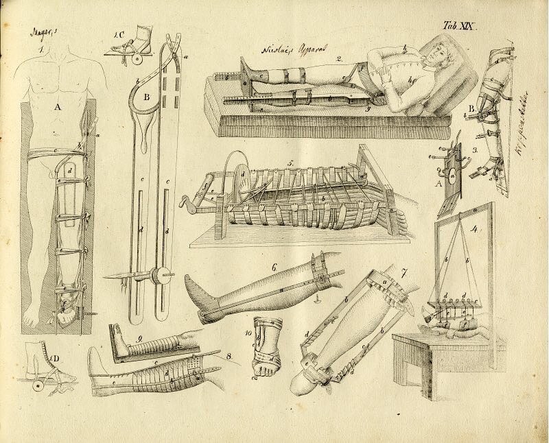 Lithographic illustrations of a collection of splints and orthopaedic devices, circa. 1829 #histmed #histsurg #historyofmedicine #historyofsurgery #pastmedicalhistory