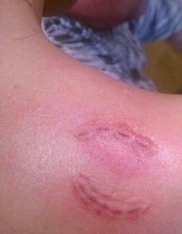 “nem te mordi com força”

a mordida: