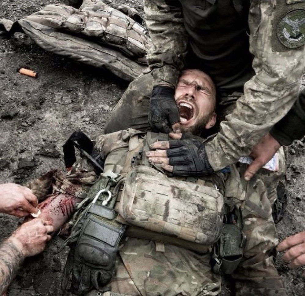 banderafella's tweet image. 🌚 #Verbove

Fending off the enemy’s ferocious assault, we’ve sustained heavy hits, with 3 wounded and 2 fallen heroes. The adversary’s ruthless, deploying FPV drones that dive bomb into dugouts, hindering evacuation — the situation’s grim. Yet, our resolve doesn’t falter.