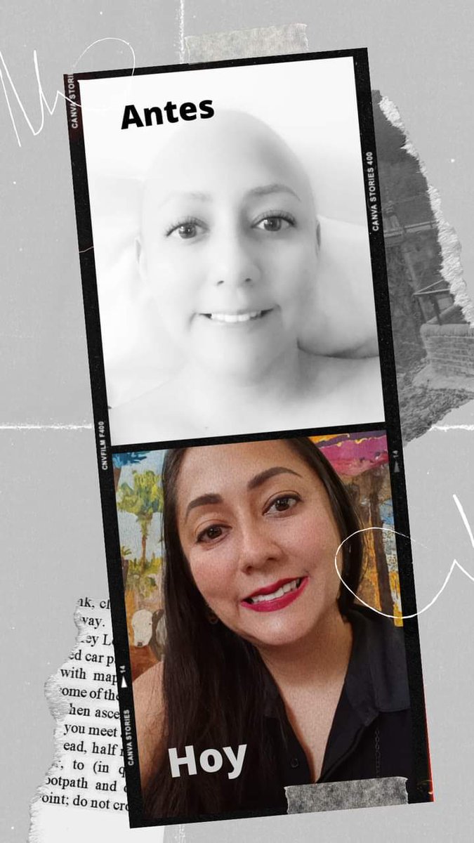 GigitaMaria's tweet photo. Un antes y después en mi vida. Un diagnóstico a tiempo puede salvar tu vida. No se descuiden... #DiaMundialContraElCancer  #fuckcancer https://t.co/pFB5ft3hg5