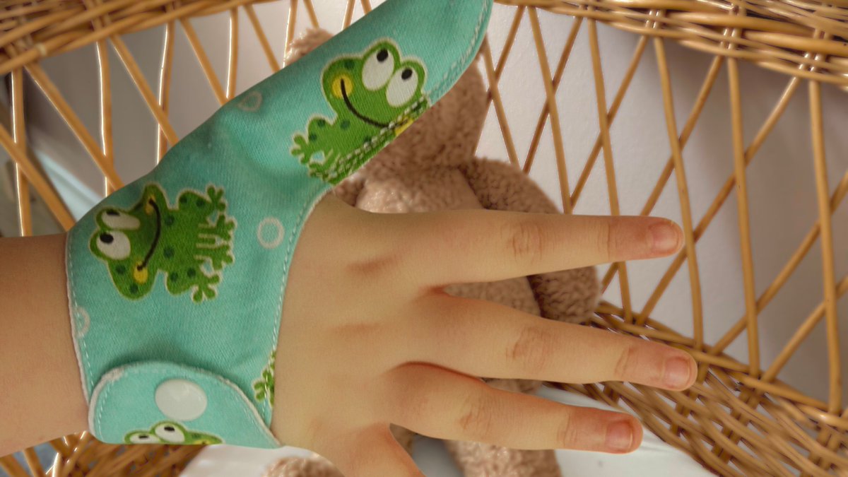 ThumbGuardsNZ's tweet image. #ThumbSucking generally stops by the age of 5. However, a child may develop a prolonged habit which can cause severe dental health problems. Our #ThumbGuards can help stop long-term sucking #Habits thethumbguardstore.etsy.com #CraftBizParty #CraftHour #MHHSBD #Parenting