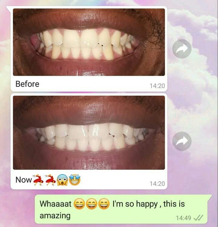 Ap24 whitening toothpaste No peroxide, non abrasive, removes stains! Cleans out coffee and cigarette stains leaving your teeth bright and clean Safe for kids Whatsapp 0783400204 🚚 Nationwide Tyla Bafana Bafana Musa Moshe Chuenza