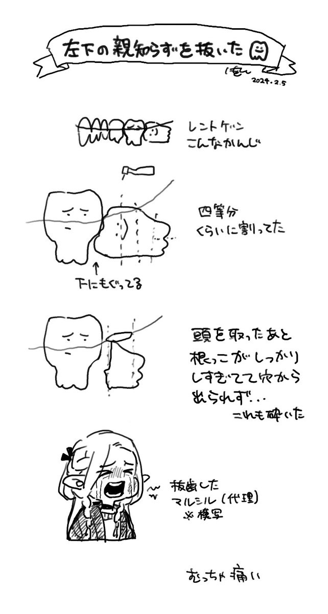 忘れないうちに記録 砕いた歯は持ってこなかった…原型わかんなかったし… 