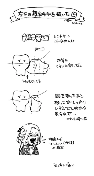 忘れないうちに記録 砕いた歯は持ってこなかった…原型わかんなかったし… 