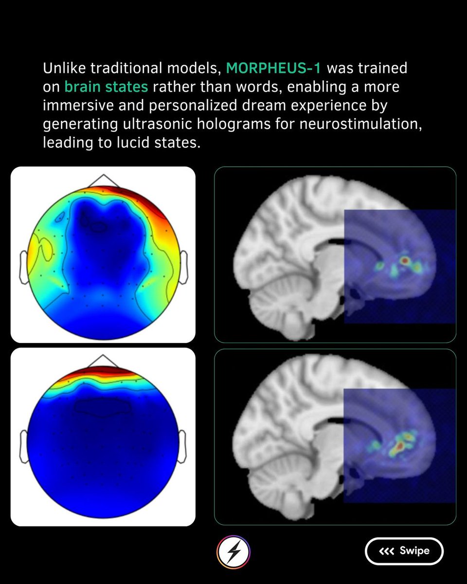 AI_infoHub's tweet image. Prophetic, a neurotechnology startup, introduces Morpheus-1, an AI model designed to induce and maintain lucid dream states.
$2,000 Halo headband induces lucid dreams with ultrasound, Prophetic&apos;s Morpheus-1 AI, stimulating the prefrontal cortex during REM. #aiheadband #ainews