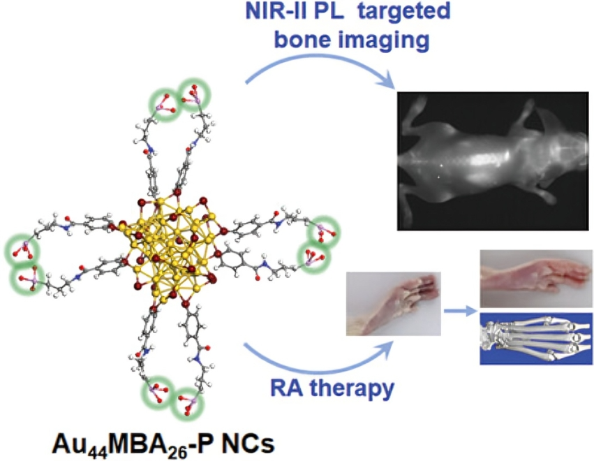 AggregateOA's tweet photo. Early Viewπ‘
"Phosphorylation of NIR-II emitting #Au #nanoclusters for targeted bone imaging and improved #rheumatoid #arthritis therapy" by Xun Yuan et al. @WileyBiomedical #ligand #NIRII #BoneImaging
Checkπhttps://t.co/Zv4mtfs4HV https://t.co/jQer9o31yq