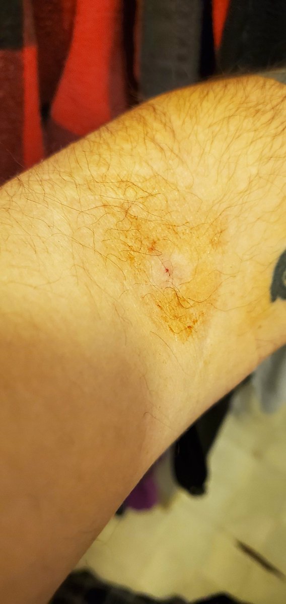 Round 2 in the books

Just 17 more to reach the  <a href="/BEANZOfficial/">BEANZ</a> dream 🫘⛩️❤️