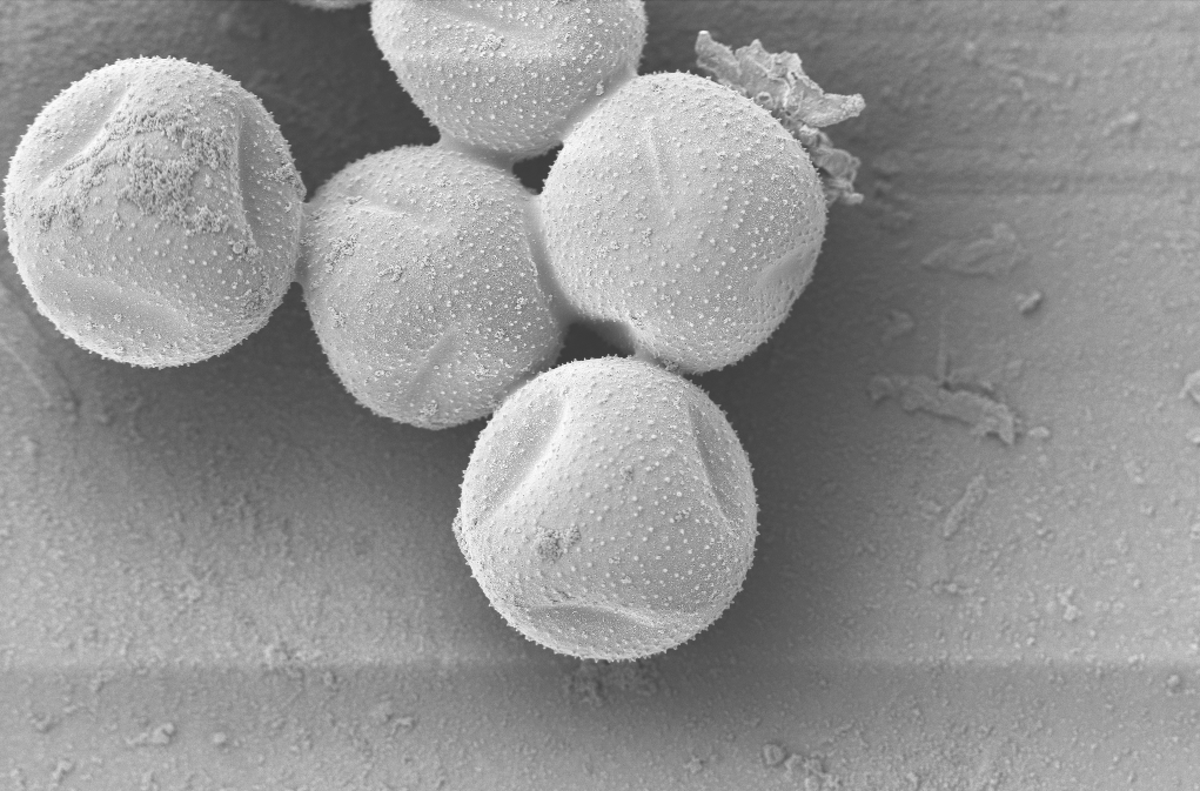 CUBG_curators (@cubg_curators) on Twitter photo We love a collab & photoshoot!
Quick and intriguing work by <a href="/kristina_buch_/">Kristina Buch</a> and Ray Wightman at <a href="/slcuplants/">Sainsbury Laboratory Cambridge University (SLCU)</a> to image the moonflower under cryo-SEM. Have a look at some of the stunning images.
Got any more ideas for research with #CUBG? Give us a holler! We love a collab & photoshoot!
Quick and intriguing work by <a href="/kristina_buch_/">Kristina Buch</a> and Ray Wightman at <a href="/slcuplants/">Sainsbury Laboratory Cambridge University (SLCU)</a> to image the moonflower under cryo-SEM. Have a look at some of the stunning images.
Got any more ideas for research with #CUBG? Give us a holler!
