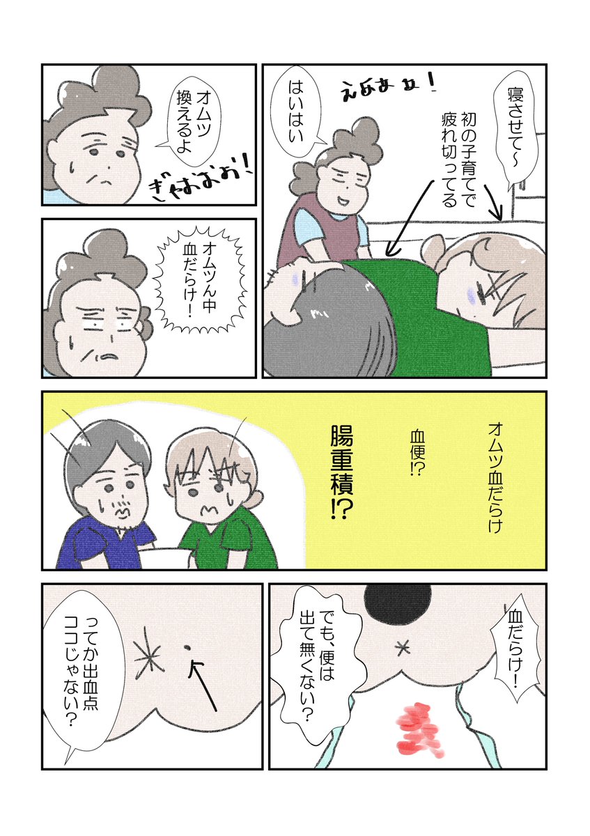 小児痔瘻(1/2)再載 
