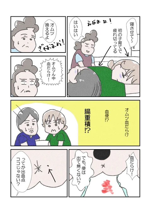 小児痔瘻(1/2)再載 