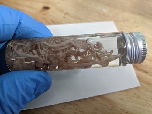 A vial full of “blood clots” from post-vax post-mortem adults. Turns out they aren't BLOOD clots at all, they are complex 'biostructures' that are growing & building inside the blood vessels & arteries. Far larger structures are being found in femoral arteries & carotid arteries.