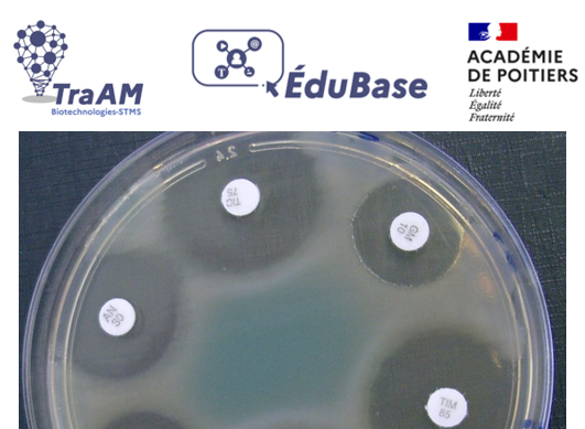 biotech_edu_num's tweet photo. [📢... Actualités Biotechnologies &amp; STMS] – Focus sur les #Antibiotiques :  des #ress_num #Edubase
✅ Scenario #TraAM
✅ Détermination de la #CMI
✅ Exploiter les résultats d'un #antibiogramme avec #ImageJ #STL cc @acpoitiers 
➡️https://t.co/UyahzFDe3L➡️ https://t.co/zGs19ojMtw https://t.co/lYs7M09Qdi