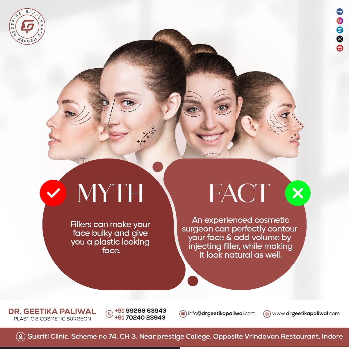 DrGeetika22's tweet photo. Myth: Fillers create unnatural results.
Fact: Dr. Geetika Paliwal's skill ensures natural beauty with precise filler application. Experience a seamless transformation.
#fillers #mythfact #cheekfillers #botox #antianging #facelift #scarsremoval #antiagingtreatment https://t.co/1S5LFRbY19