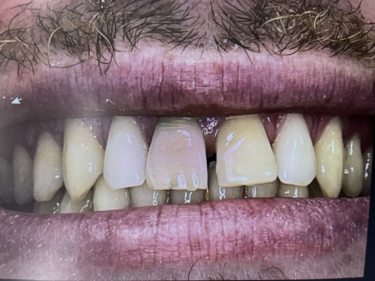 SurgeryHouse's tweet photo. Before and after https://t.co/9gbEtnWNhz