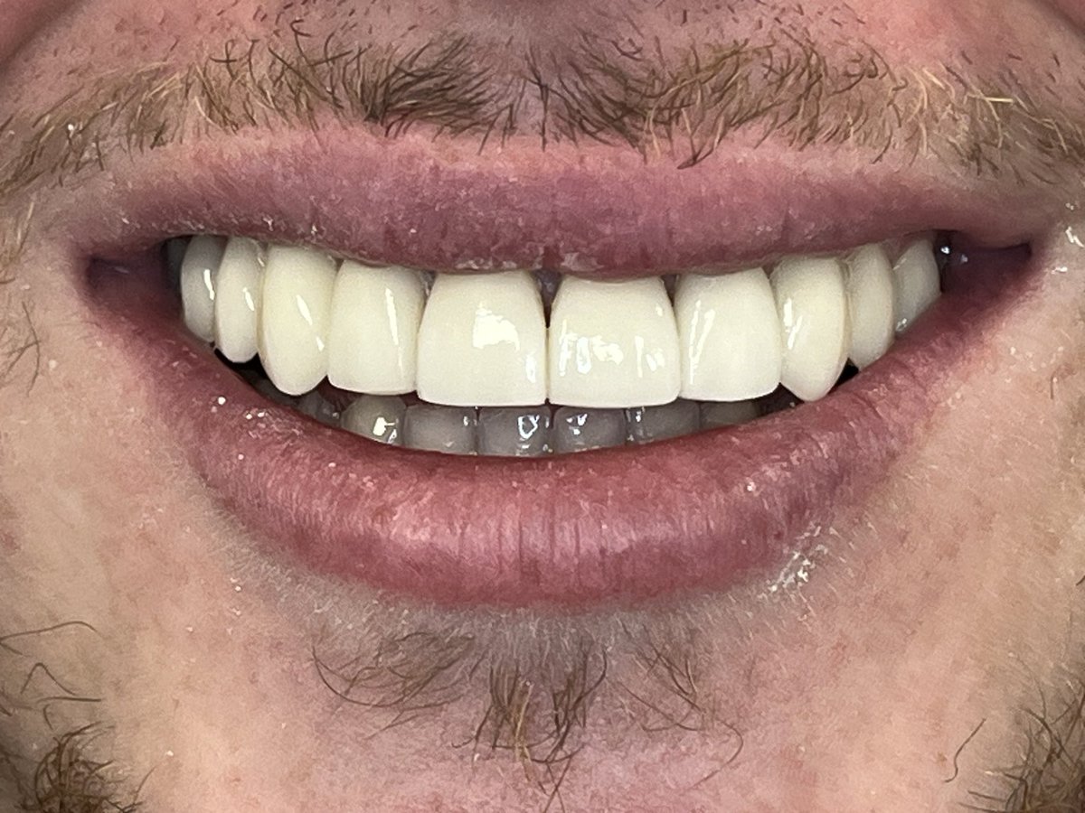 SurgeryHouse's tweet photo. Before and after https://t.co/9gbEtnWNhz