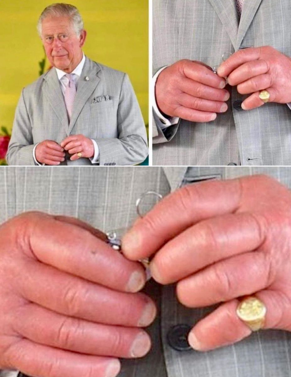 Fingers of Charles III, King of England