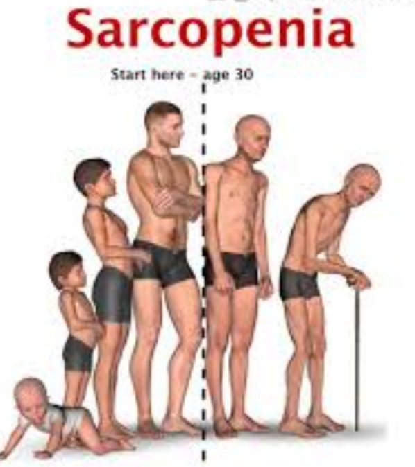 Starting at age 30, the average person loses 3kg muscle each decade. 

You can choose to avoid Sarcopenia by prioritizing protein & strength training.

Age strong with me.....
#ladiesthatlift #girlmuscles #fit50+ #carnivore #weightlift #liftheavy