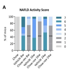MathiasFlensted's tweet photo. The good news is that a both an 8, 16 and 24-week dietary intervention (chow reversal) lead to a significant reduction in NAFLD activity score and markers of inflammation, fibrogenesis and liver damage. 9/13 https://t.co/7d0DsDtPbD