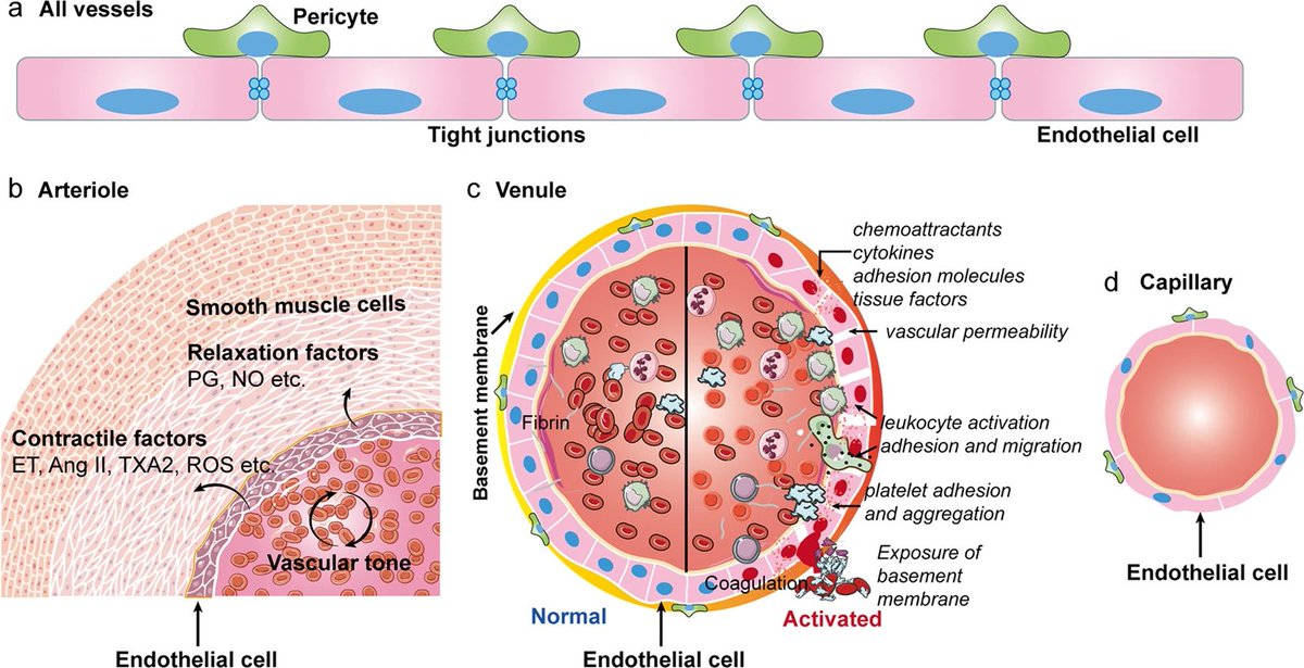 vipintukur's tweet image. SARS-CoV-2 causes deterioration of numerous systems with increasing evidence implying that COVID-19 affects endothelium and vascular function. Endothelial dysfunction plays a crucial role in the pathophysiology of SARS-CoV-2. 3/