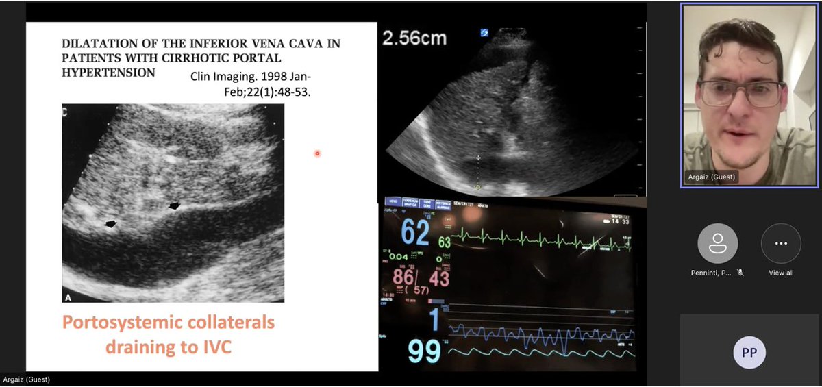 Pranav Penninti tweet media