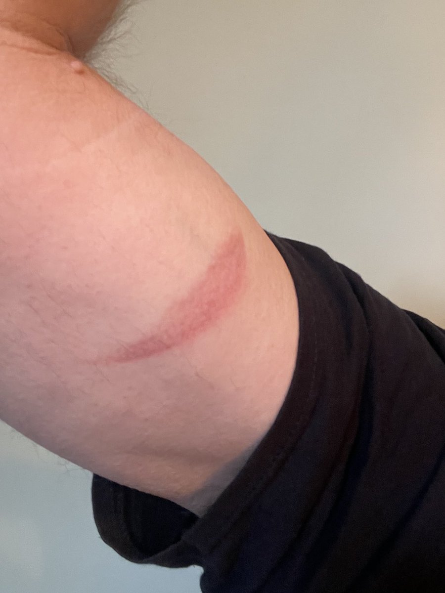 Travis Kvapil tweet media