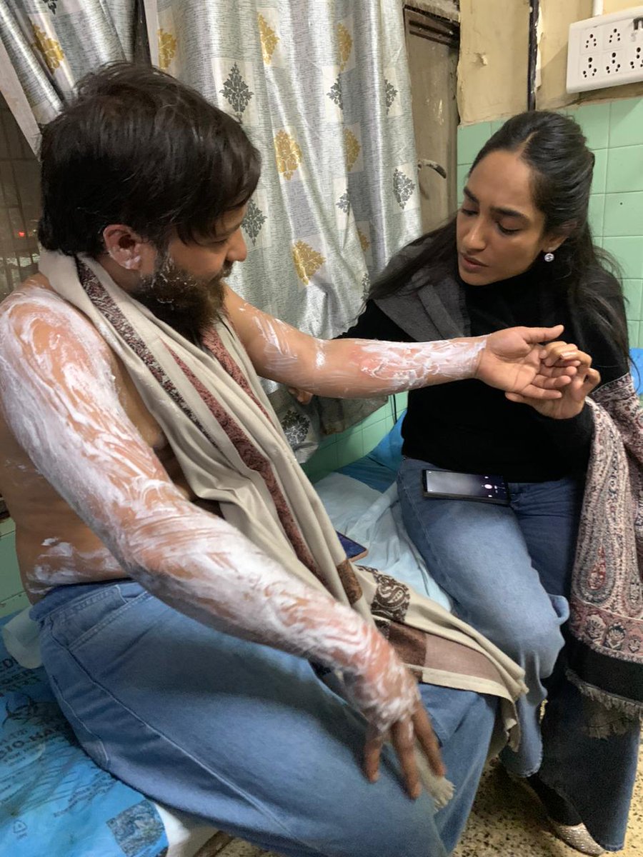 DrRituSingh_'s tweet photo. Today RSS goons brutally attacked @ashu_vidrohi dalit student leader in the evening at around 6pm, at Arts Faculty near gate no 4! पर वाइस चांसलर और प्रॉक्टर के कहने पर चाकू और डंडे से और लाठी से वह खोलते हुए गरम चाय उनके मुंह और शरीर पर फेक दि ! https://t.co/3AlPOkcv11