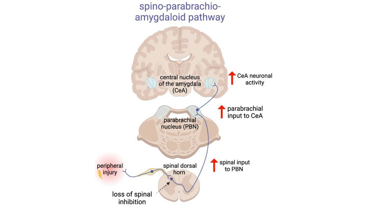 ACNP (@acnporg) on Twitter photo Have you read the latest research uncovering the PBN -> CeA circuit's role in chronic pain by Torres and Rodriguez et al. from <a href="/YarCarLab/">Yarimar Carrasquillo</a> in <a href="/npp_journal/">Neuropsychopharmacology</a>? Check out the Research Highlight shedding light on this pivotal pathway rdcu.be/dxlVF <a href="/tylernelson406/">Tyler Nelson</a> <a href="/Hea6ther/">Heather Allen</a> Have you read the latest research uncovering the PBN -> CeA circuit's role in chronic pain by Torres and Rodriguez et al. from <a href="/YarCarLab/">Yarimar Carrasquillo</a> in <a href="/npp_journal/">Neuropsychopharmacology</a>? Check out the Research Highlight shedding light on this pivotal pathway rdcu.be/dxlVF <a href="/tylernelson406/">Tyler Nelson</a> <a href="/Hea6ther/">Heather Allen</a>