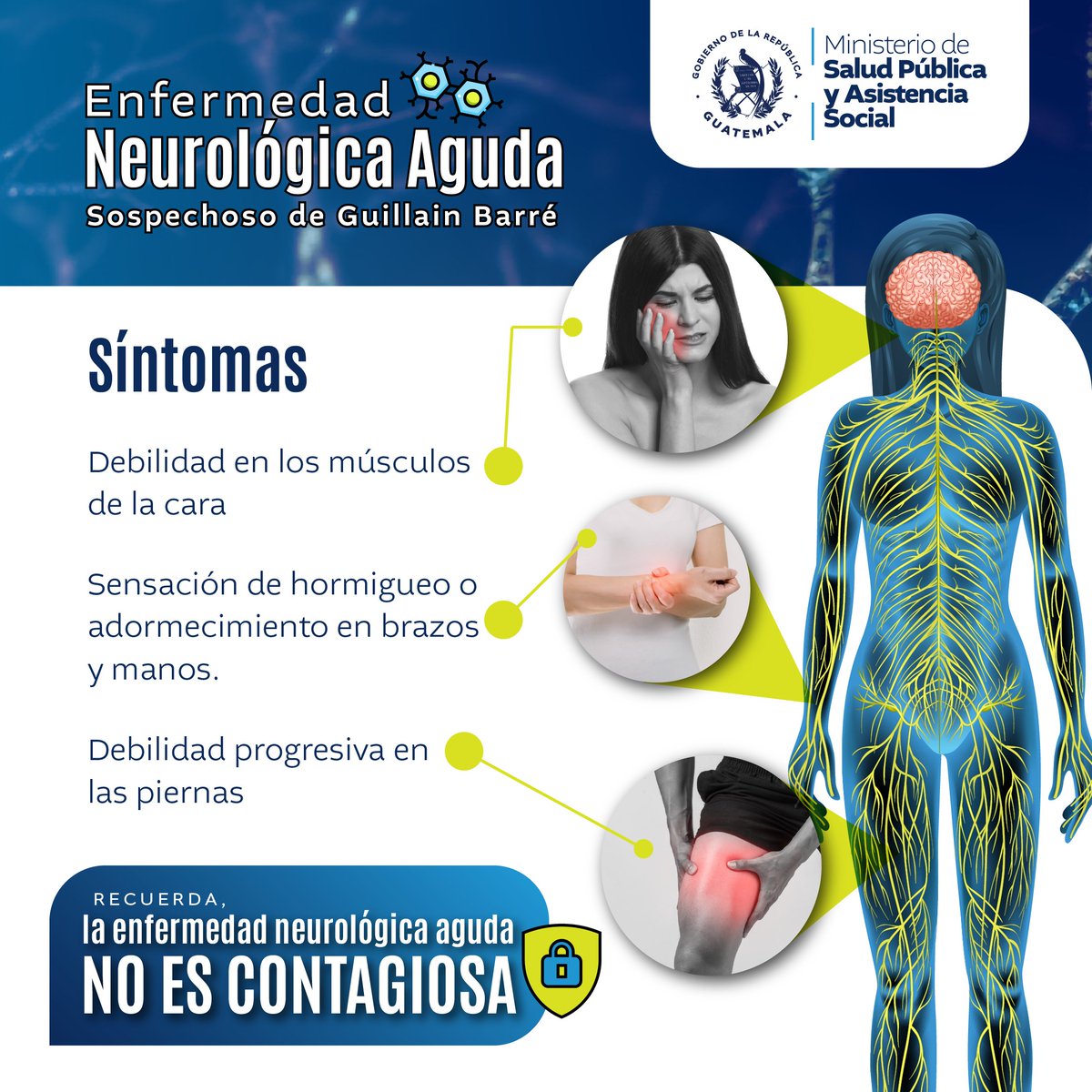 MinSaludGuate's tweet photo. 🚨 ¡Importante! 🚨
La enfermedad neurológica aguda sospechoso de Guillain Barré, no es contagiosa de persona a persona. Mantengamos la serenidad y sigamos las indicaciones del Ministerio de Salud #MSPAS para un cuidado comunitario efectivo. 🤲💙 👇 https://t.co/I8Nx3eqjWw