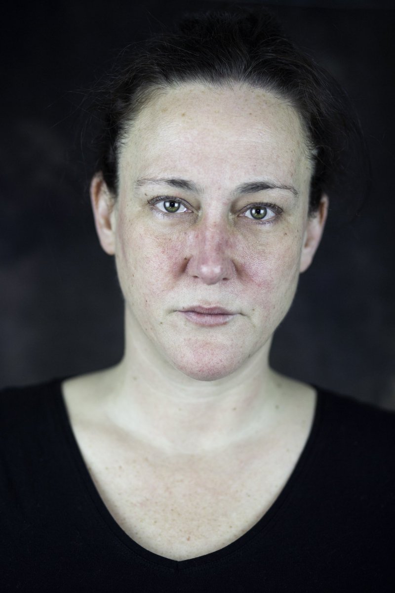 So I have done something which I am a little scared of sharing with the world, but I am trying to embrace who I am, what I look like, rather than hide from it. I have Rosacea (it can be covered with make up) But I thought, no I am me, I am unique and I should be proud. So I