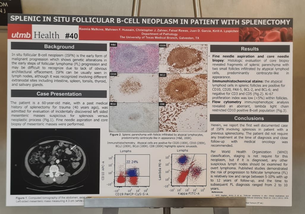 Kseniia Malkova, MD (@malkovamd) on Twitter photo Texas Society of Pathology annual meeting 2024!
Thanks to <a href="/KirillLyapichev/">Kirill Lyapichev</a> for such a unique case! Texas Society of Pathology annual meeting 2024!
Thanks to <a href="/KirillLyapichev/">Kirill Lyapichev</a> for such a unique case!