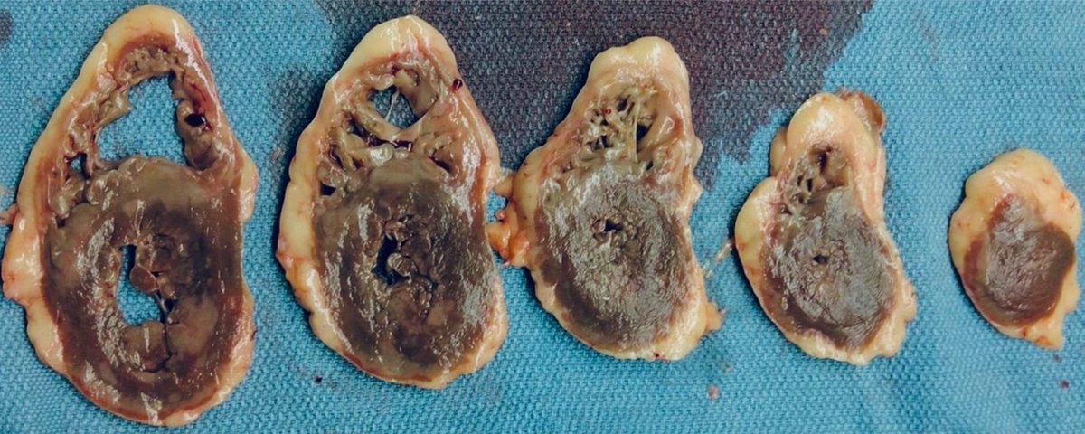 UArizona Pathology & Laboratory Medicine tweet media