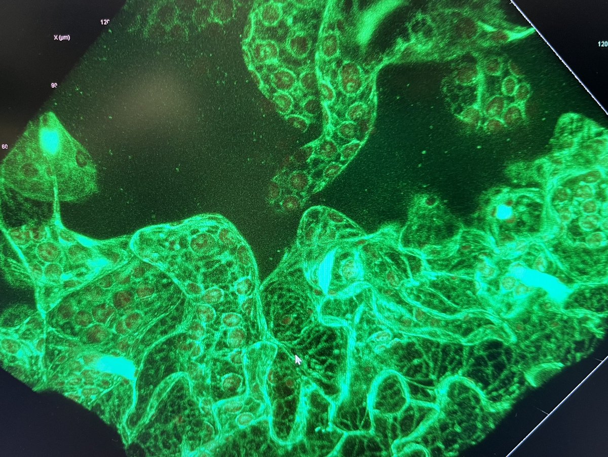 Another fantastic screening <a href="/schwarzland_lab/">Plant Energy Biology Lab</a> with Ana Furlanetto 🌱🔬