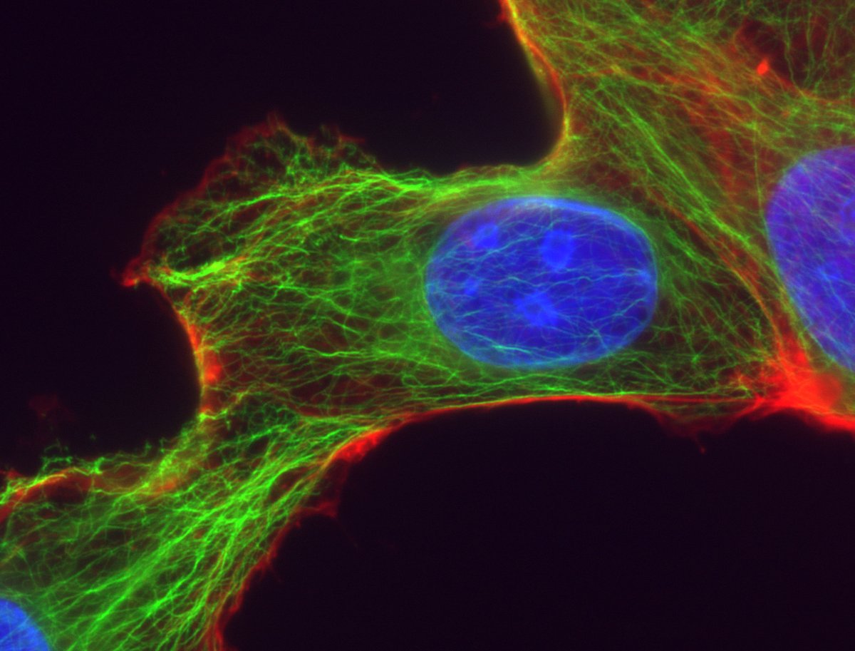 NEW AT CYTOSKELETON @cytoskeljournal. NO EDITORIAL (Desk) REJECTIONS if your paper is within the journal’s scope. IT WILL GO OUT FOR REVIEW! We want your papers. #FREE to publish. #CYTOSKELETON is your home for ALL cytoskeletal research. #microscopymonday onlinelibrary.wiley.com/page/journal/1…