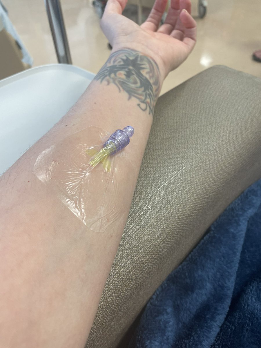 VinoNStrosGal's tweet photo. A brand new (painless) area for my IV. My RN is wonderful. I feel grateful and blessed.🙏🏼❤️
#Infusionday #POTS https://t.co/eQmu0fJm4D