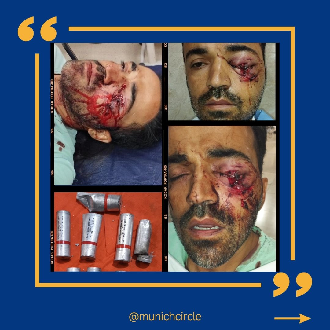 Farzad Moradinia wurde von den Regimeschergen brutal verletzt und musste schließlich seine Heimat aufgrund der massiven Bedrohungen verlassen. The Munich Circle e.V. ermöglichte ihm in Zusammenarbeit mit den Deutschen Behörden die Einreise nach Deutschland