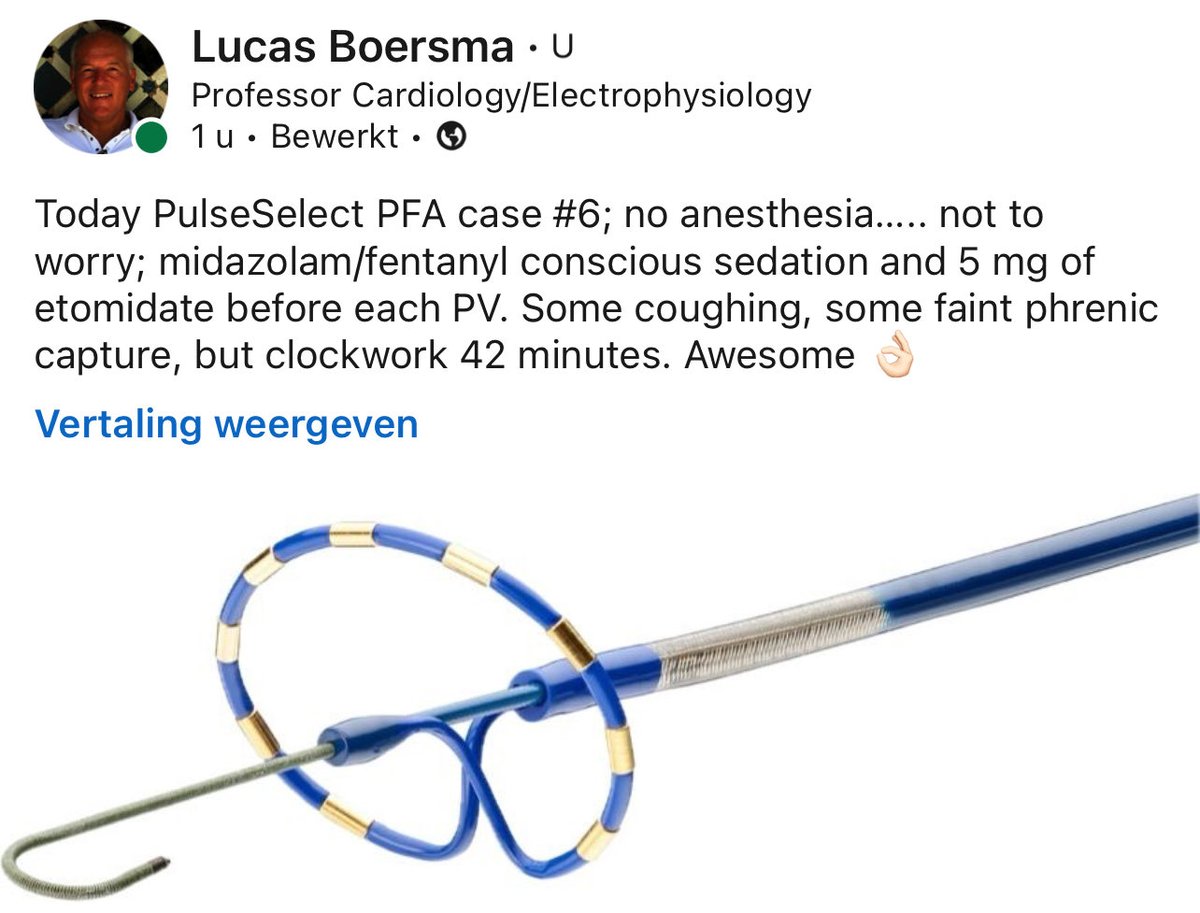 PulseSelect PFA can be done under local anesthesia, conscious sedation with midazolam/fentanyl, and a hint of etomidate 👌🏻