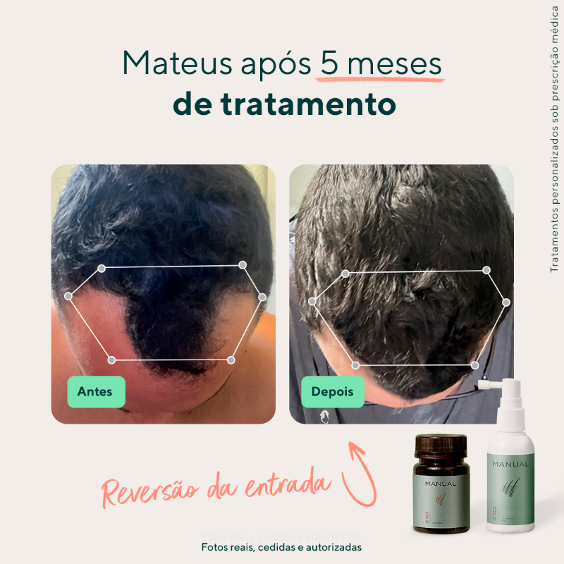 MANUAL_cabelo's tweet photo. Quer tratar a calvície? A MANUAL tem tudo o que você precisa para deixar o cabelo onde ele deve ficar! 💪