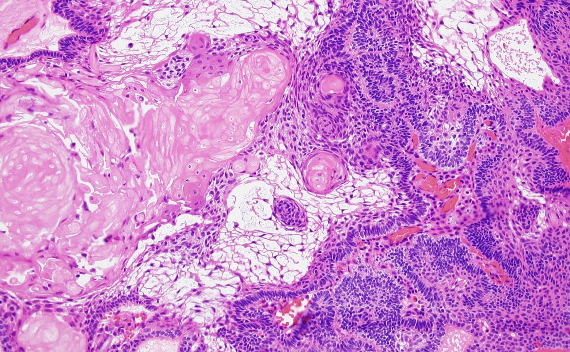 Jared T. Ahrendsen MD, PhD (AP/NP/FP) tweet media