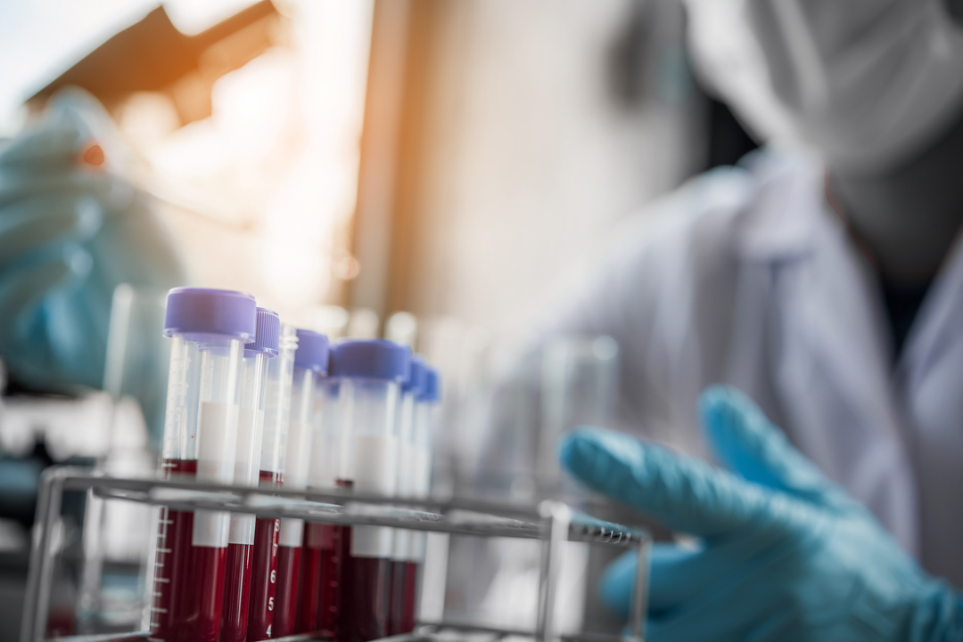 Innovative Research is excited to share our top 5 biological products that are making waves in the scientific community right now.  Read Our Latest Blog Post to find out what the trending products are. innov-research.com/blogs/product-…